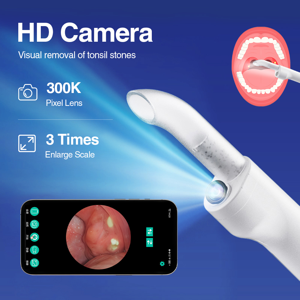スマートな視覚機能付きの扁桃腺石除去キット。内蔵LEDライト - Lighting Visual のレビューと価格