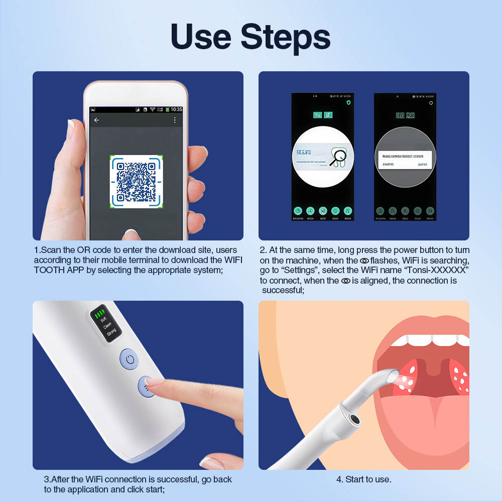 スマートな視覚機能付きの扁桃腺石除去キット。内蔵LEDライト - Lighting Visual のレビューと価格
